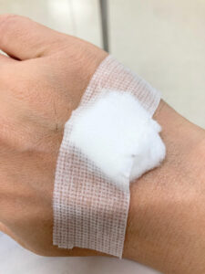 虫垂炎で突然の入院＆腹腔鏡手術｜痛みは？術後の過ごし方は？子どもと猫たちは？リアル体験ブログ