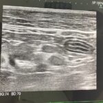 シニア猫の嘔吐と下痢・しぶり便…腸管型リンパ腫？膀胱炎？動物病院に駆け込んだ話