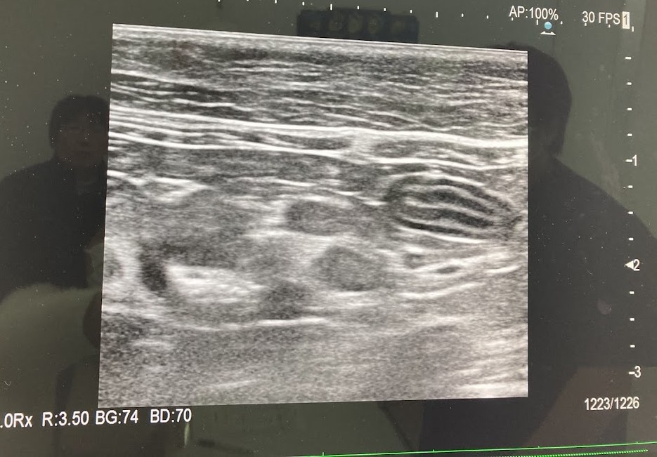 シニア猫の嘔吐と下痢・しぶり便…腸管型リンパ腫？膀胱炎？動物病院に駆け込んだ話