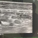 【体験談】シニア猫の体調不良の原因は肝臓ガン…後悔していることなど