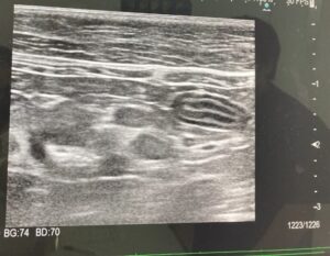 【体験談】シニア猫の体調不良の原因は肝臓ガン…後悔していることなど