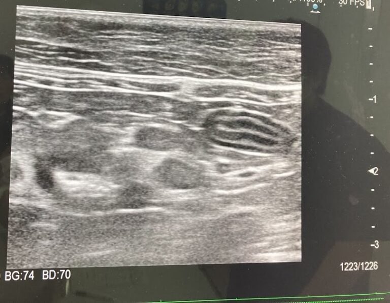 【体験談】シニア猫の体調不良の原因は肝臓ガン…後悔していることなど